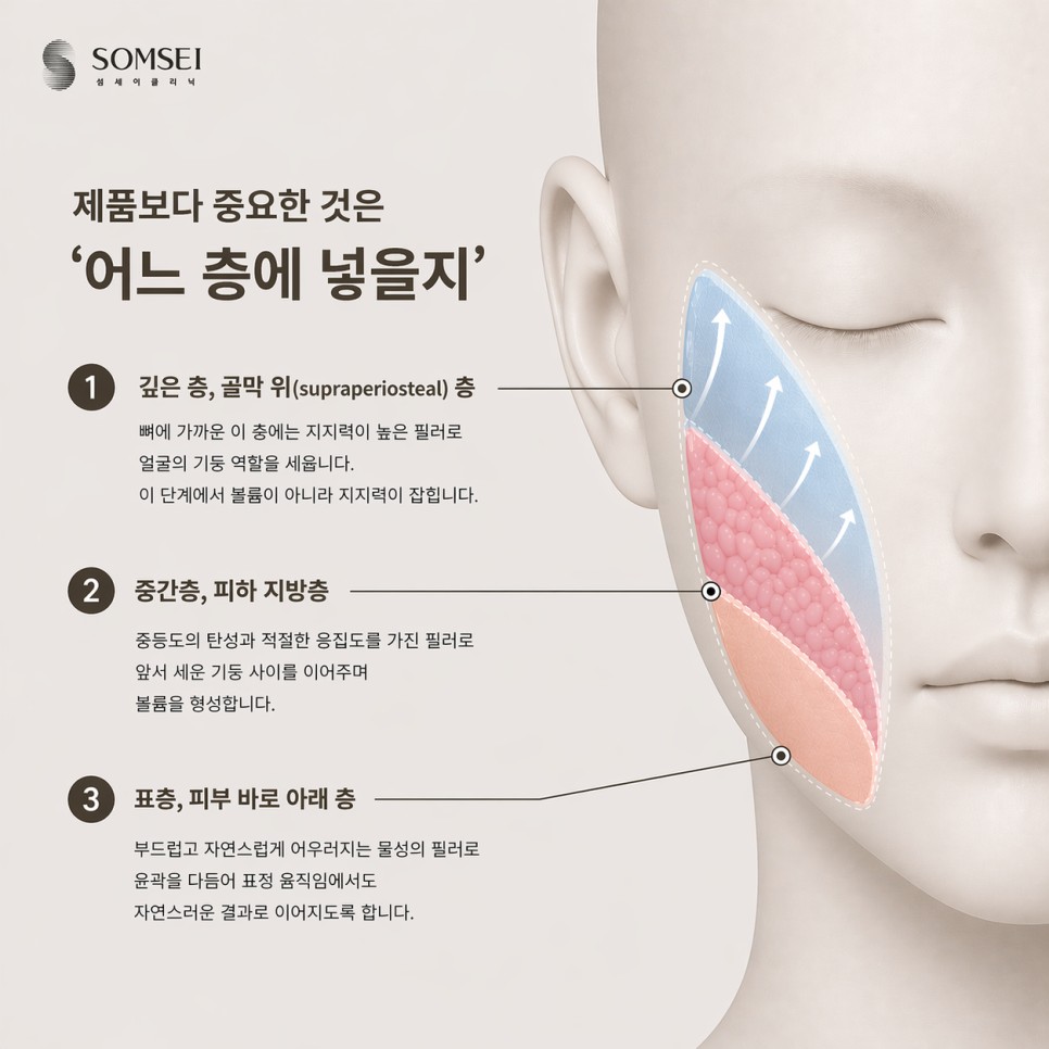 깊은 층·중간층·표층 필러 주입 도식