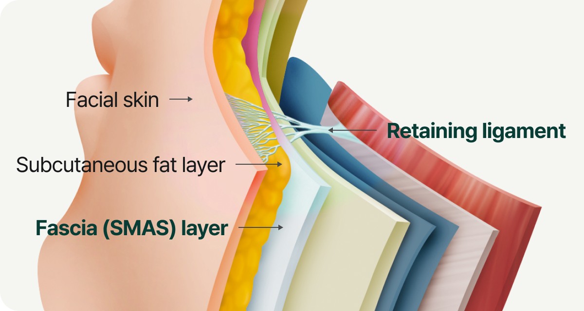 피부·피하지방·SMAS 층과 retaining ligament 도식