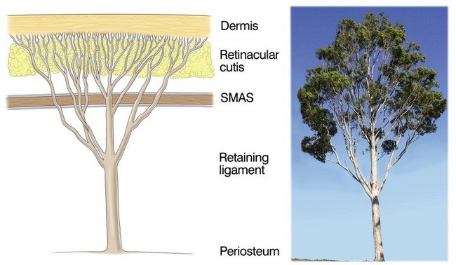 retaining ligament를 나뭇가지에 비유한 도식