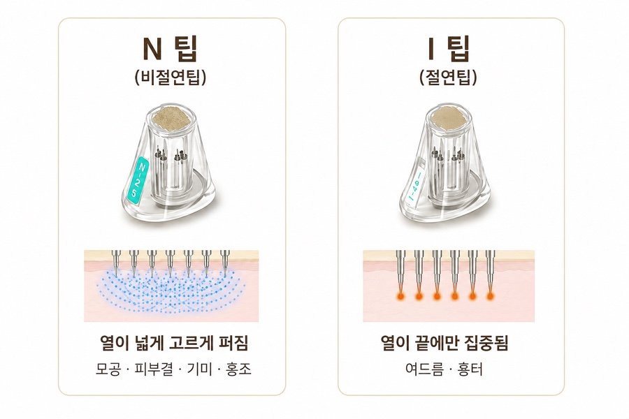 N팁과 I팁 열 분포 비교