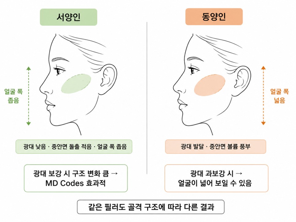 서양인과 동양인 골격 구조에 따른 필러 결과 차이