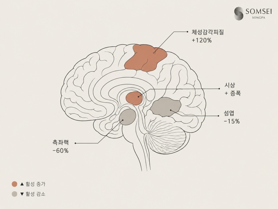 수면 부족 때 체성감각피질·섬엽·측좌핵 활성 변화