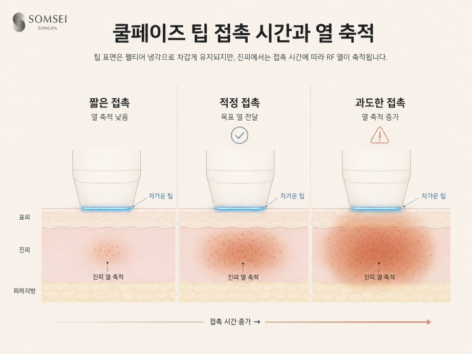 쿨페이즈 팁 접촉 시간과 열 축적