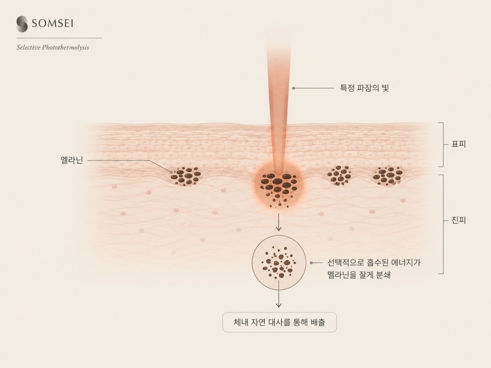 선택적 광열분해 모식도