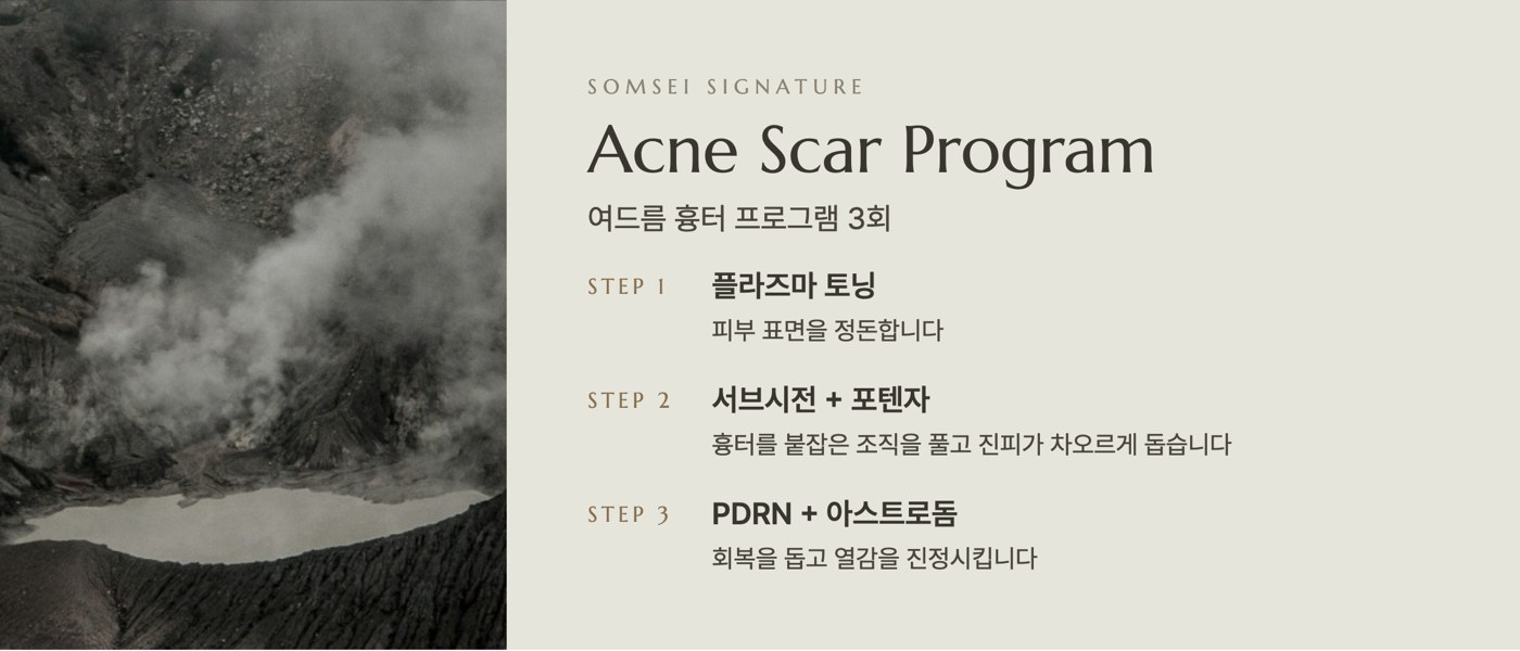 섬세이 여드름 흉터 프로그램 구성